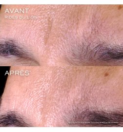 Rénergie C.R.x. Triple Serum Retinol Facial Serum Rénergie C.R.x. Triple Serum Retinol Facial Serum